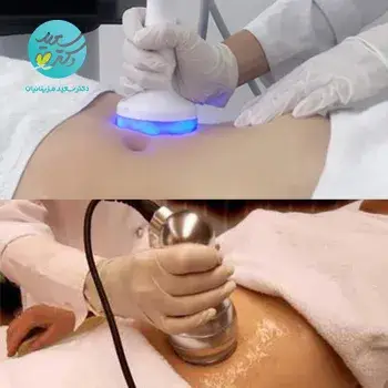 آر اف(15 دقیقه) + کویتشن(15 دقیقه)