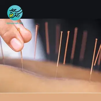 طب سوزنی زیبایی