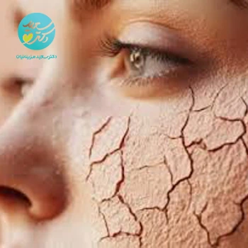 پکیج خشکی صورت