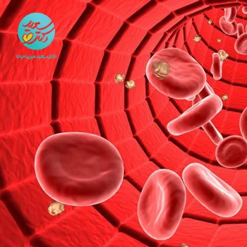 پکیج غلظت خون