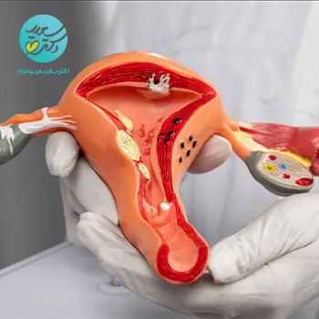 پودر گیاهی آمادگی رحم
