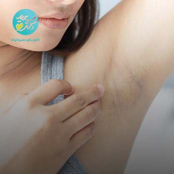 پکیج تیرگی پوست بدن