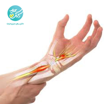 پکیج تنگی کانال مچ دست یا پا