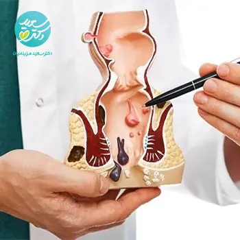 پکیج بواسیر