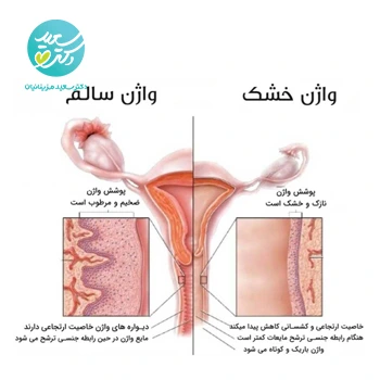 پکیج خشکی واژن