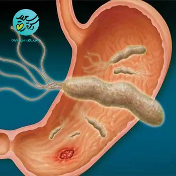 پکیج عفونت معده