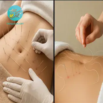 امبدینگ (یک بسته نخ)