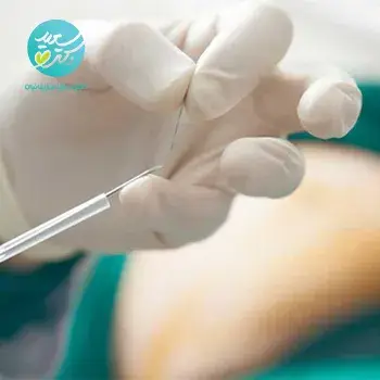 مزو امبدینگ گرید 4