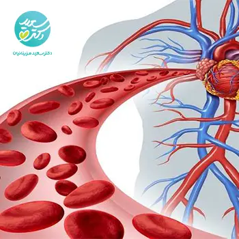 قرص بازکننده عروق