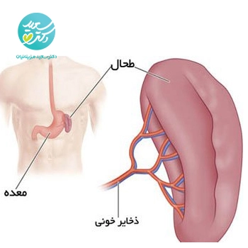 پکیج طحال (پاکسازی سودا)