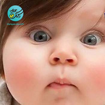 پکیج چاق کننده صورت