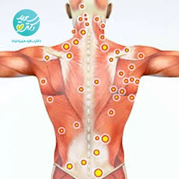 پکیج گرفتگی عضلات