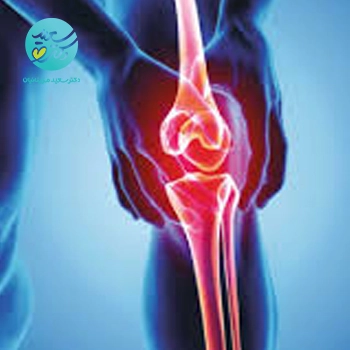 پکیج آرتروز