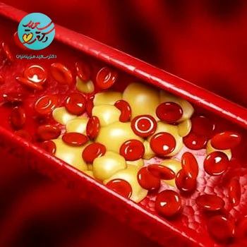 پکیج چربی خون