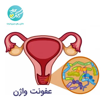 پکیج عفونت زنان