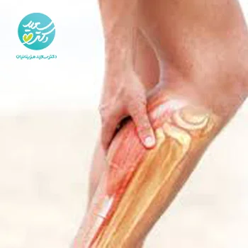 پکیج گرفتگی عضلات ساق پا