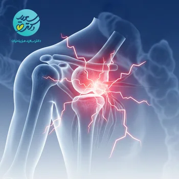 پکیج در رفتگی مکرر مفاصل