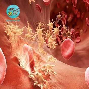 کپسول پلاکت و خونریزی