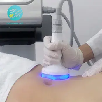 آر اف (15 دقیقه)