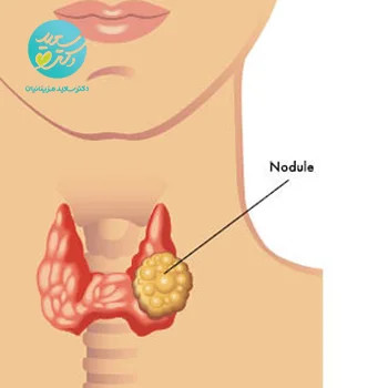 پکیج ندول تیروئید