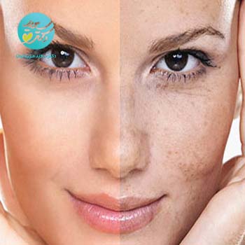 پکیج ضد لک و جوانساز دست