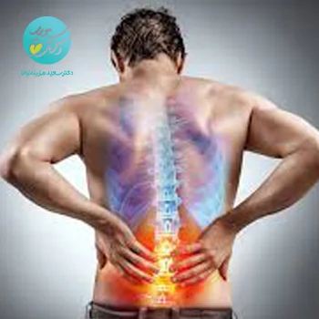 پکیج دیسک کمر و تنگی کانال نخاعی