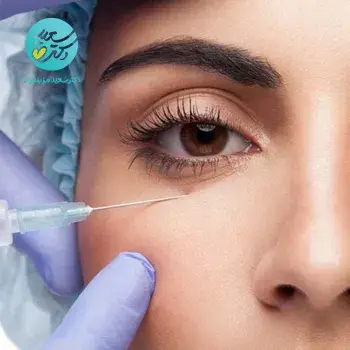 رفع مشکلات دور چشم با مزوتراپی