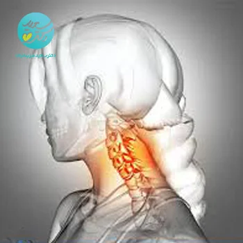 پکیج دیسک گردن