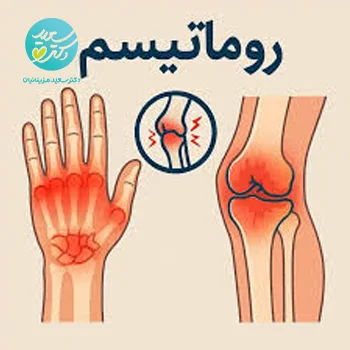 پکیج روماتیسم