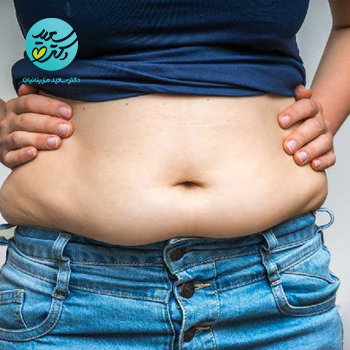 پکیج لاغرکننده شکم و پهلو موضعی