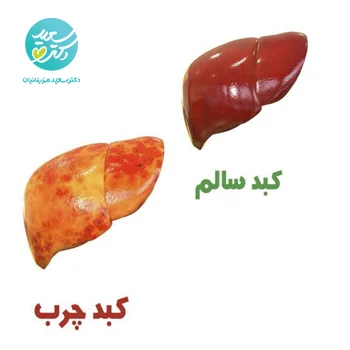 پکیج  پاکسازی و درمان کبد چرب
