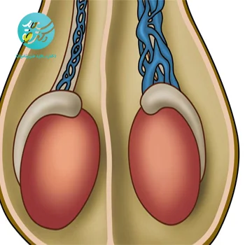 پماد واریکوسل