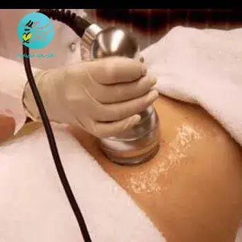 کویتیشن (20 دقیقه)