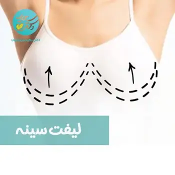 پکیج لیفت سینه