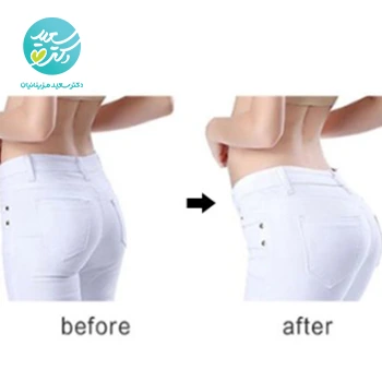 کرم حجم دهنده باسن