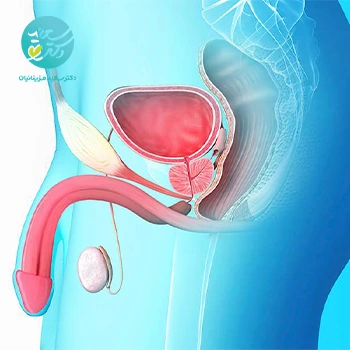 پکیج پروستات (قرص-روغن خوراکی-روغن موضعی)