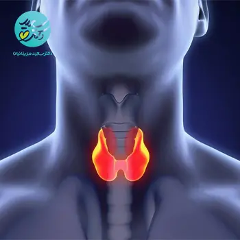 روغن کم کاری تیروئید